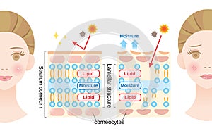 Healthy skin and dry skin diagram. structure of stratum corneum and lamellar structure, which play the protective role for skin photo