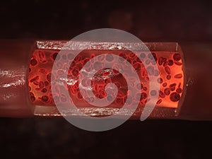 Streaming blood cells