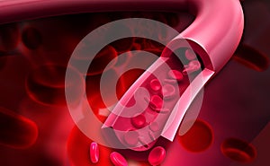 Streaming blood cells