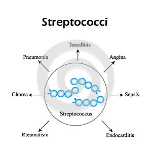 Streptococci. Streptococcal diseases. Infographics. Vector illustration