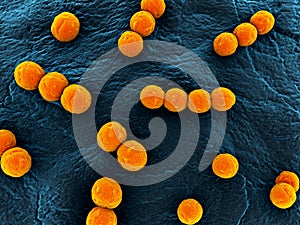 Streptococcus photo