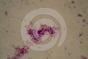 Streptococcus lactis bacteria 400x