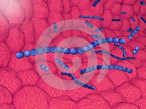 Streptococcus pyogenes