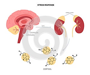 Stress responce system