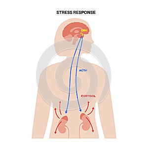 Stress responce system