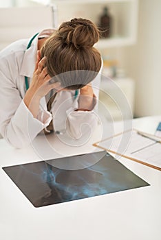 Stressed doctor woman with fluorography photo