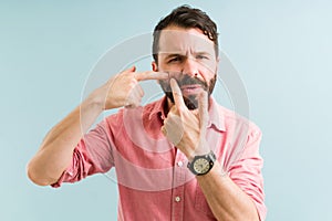 Stressed man with skin problems making eye contact