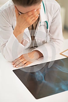 Stressed medical doctor woman with fluorography photo
