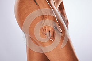 Stretch marks, cellulite and woman touching her legs  on a grey studio background. Health, skincare and zoom of