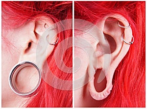 Stretched ear lobe piercing