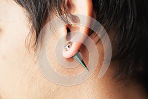 Stretching ears for larger diameter tunnels,piercer hand inserts the piercing in the ear photo