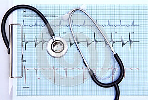 Strethoscope on heartbeat graph