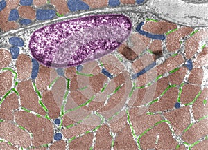 Striated muscle fiber