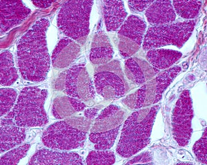 Striated muscle fiber. Myofibrils