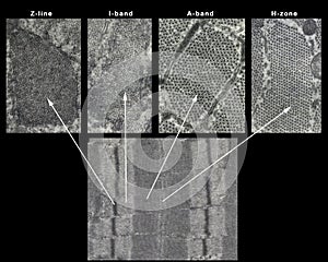 Striated muscle fiber sarcomere photo