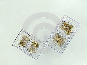 Striatella unipunctata algae under microscopic view