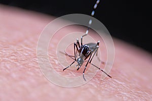 Striped mosquitoes are eating blood on human skin