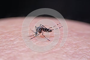 Striped mosquitoes are eating blood on human skin photo