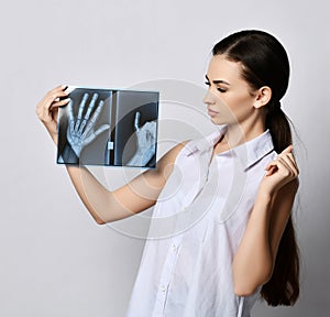 Strongly puzzled brunette woman doctor or clinic patient looks at hands X-ray examination