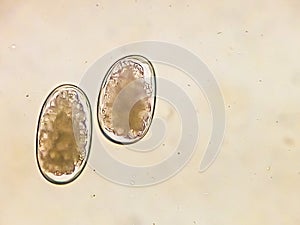 Strongyle eggs under the microscope, Uncinaria/Ancylostoma, hookworm from dog` s faeces photo