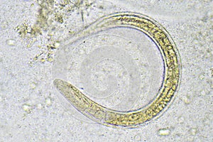 Strongyloides stercoralis