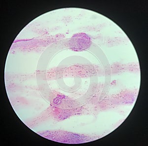 Strongyloides stercoralis parasit in human