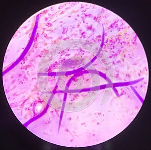 Strongyloides stercoralis parasit in human photo