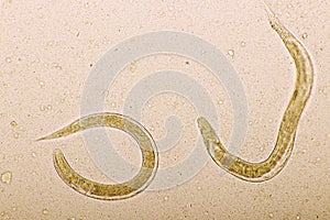 Strongyloides stercoralis or threadworm in human stool