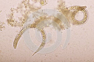 Strongyloides stercoralis or threadworm in human stool