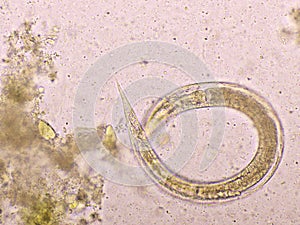 Strongyloides stercoralis or threadworm in human stool