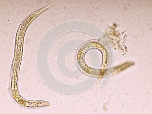 Strongyloides stercoralis or threadworm in human stool