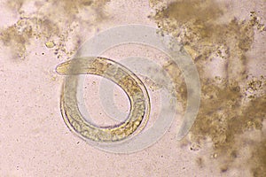 Strongyloides stercoralis or threadworm in human stool