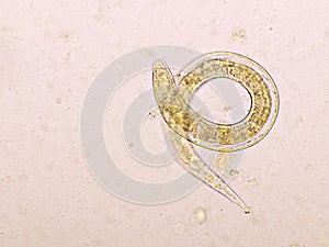 Strongyloides stercoralis or threadworm in human stool