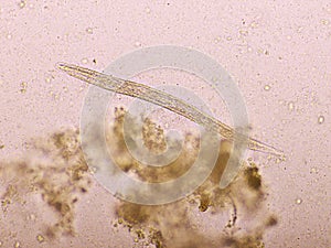 Strongyloides stercoralis or threadworm in human stool