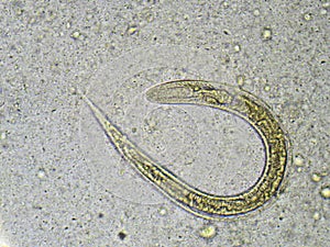 Strongyloides stercoralis