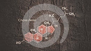 Structural chemical formula of cholesterol. Infographics illustration.