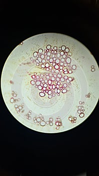 Structure of beet root under a microscope