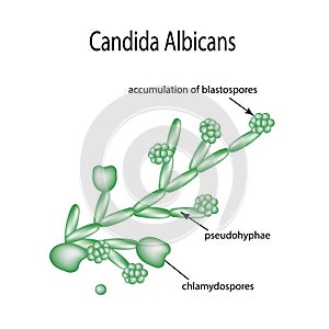 Structure of Candida albicans. Infographics. Vector illustration on background