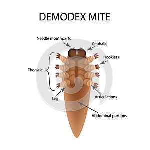 The structure of the demodex mite. Demodecosis. Infographics. Vector illustration on background.