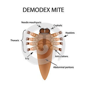 The structure of the demodex mite. Demodecosis. Infographics. Vector illustration on isolated background.