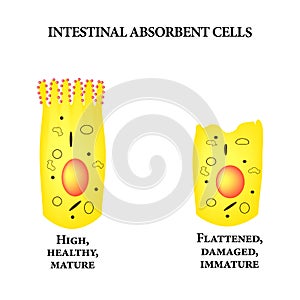 Structure of the enterocyte. Deformed, sick cell. absorptive cells intestine. Infographics. Vector illustration