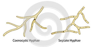 The structure of a fungal hyphae. Coenocytic Hyphae, Septate Hyphae photo