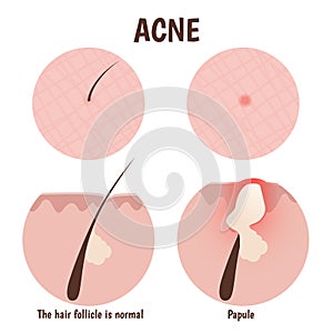 Structure of the hair follicle