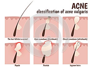 Structure of the hair follicle