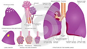 Estructura de hombre pulmones 