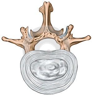 Structure of an intervertebral disk