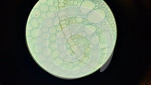 Structure of iris root, microscopic photography