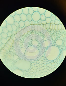 Structure of iris root, microscopic photography