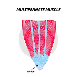 The structure of skeletal muscle. Multipennate muscle. Tendon. Infographics. Vector illustration on isolated background.