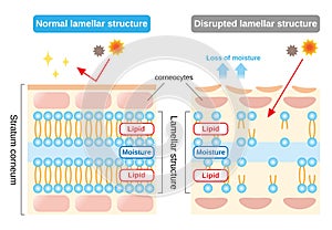 Structure of stratum corneum and lamellar structure, which play the protective role for skin barrier functions. beauty and skin